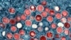 Kenya on alert after case of mpox confirmed