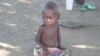 Criança subnutrida em Namibe