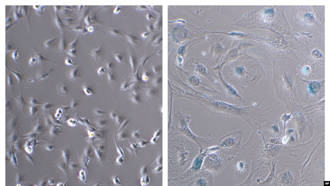 This combination of microscope photos provided by the Mayo Clinic in August 2022 shows healthy myoblast cells, left, and senescent ones. Senescent cells resist apoptosis, or programmed cell death, and characteristically get big and flat. (Dr. Xu Zhang/Mayo Clinic via AP)