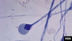 La mucormicosis la define Medline Plus como infección micótica en los senos paranasales y que se puede extender al cerebro y los pulmones, tiene mayor presencia en personas con sistemas inmunológicos comprometidos. Este hongo suele encontrarse en materia orgánica en descomposición como frutas, pan, vegetales al igual que en la tierra y el abono. “La infección rinocerebral puede empezar como una infección sinusal y luego provocar inflamación de los nervios que provienen del cerebro”. (Ilustración CDC /Dr. Lucille K. Georg)