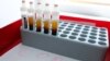 Blood samples are prepared for testing for the corona virus at a laboratory in Berlin, Germany, March 26, 2020.