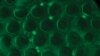 CD4 cells (bright green) are captured in between posts in an anti-CD4 capture chamber, which is part of the newly developed lab-on-a-chip. (Science Translational Medicine/AAAS)