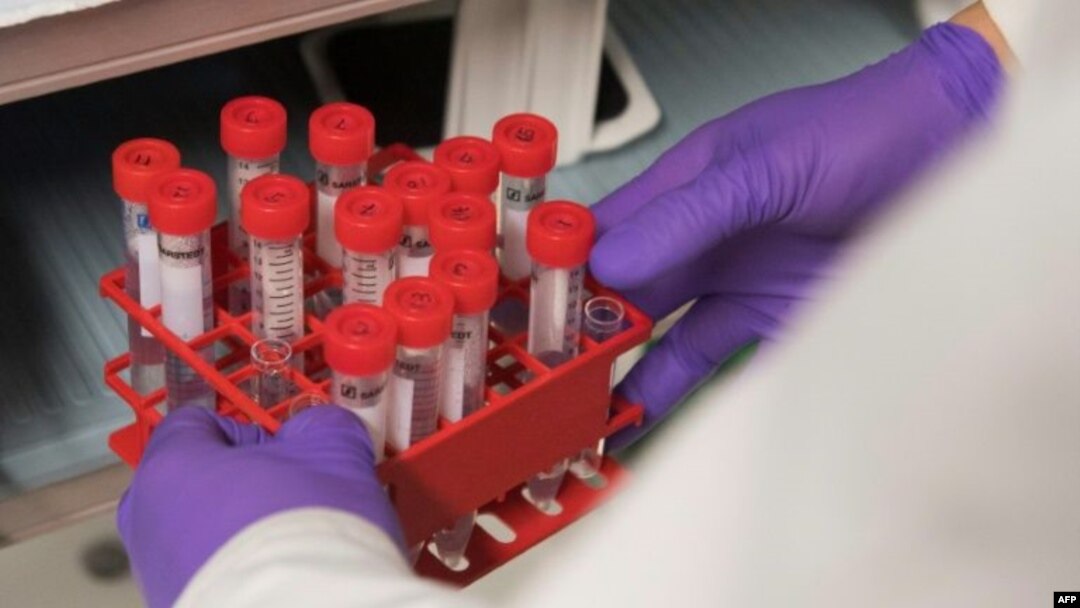 Hiromitsu Nakauchi's research centers on creating animal embryos that contain human cells. If the experiments are successful, researchers hope to someday grow human-sized organs in animals like pigs and sheep.(AFP Photo/SAUL LOEB)