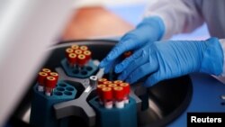 A health worker is seen with blood samples during a testing of municipal workers from the Miraflores district of Lima for the coronavirus disease (COVID-19), in Lima, Peru April 13, 2020.