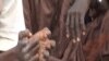 Hands of people handicapped by leprosy, Yaounde, Jan. 21, 2021. (Moki Edwin Kindzeka/VOA)