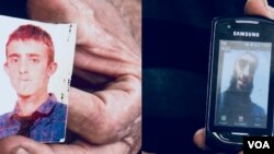 Fotografitë e Agon Misinit para dhe pas shkuarjes ne Siri