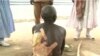 FILE - A man wounded in an attack by Boko Haram is pictured in Mora, Cameroon, Dec. 11, 2019. (Moki Edwin Kindzeka/VOA)