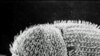 A bacterial gene has found its way into the genetic material, or genome, of an insect called the coffee berry borer.