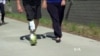 Researchers Develop Artificial Legs That Mimic Real Ones